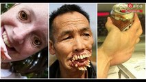 These are the most disturbing photos EVER! U won't make it till the end!!!