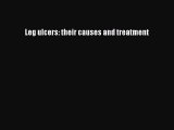 Download Leg ulcers: their causes and treatment Ebook Free