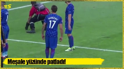Bomba yüzünde patladı!
