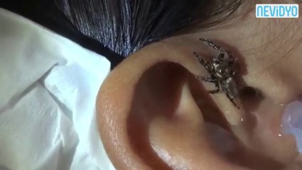 Kulağa kaçan örümcek nasıl çıkarılır