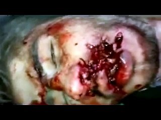 المركز الإعلامي السوري ريف دمشق دوما الشهيد محمود الدرة 29 12 2011    دلشاد علي