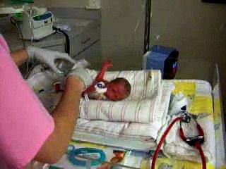 My Niece Lauryn born at 28 weeks, 2 lbs 7 oz