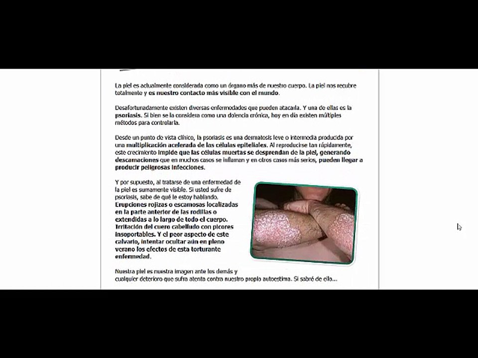 como curar la psoriasis con un remedio super eficaz y comprobado