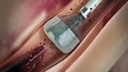 New technology in medical field 