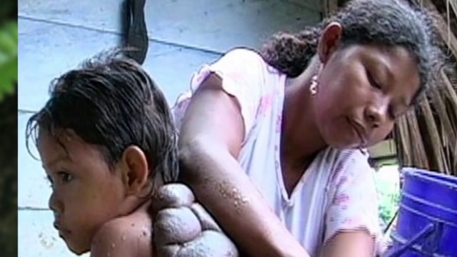 10 Людей, с ЖЕСТКИМИ МУТАЦИЯМИ, встречающихся у людей к счастью, довольно редко