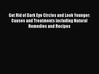 Read Books Get Rid of Dark Eye Circles and Look Younger: Causes and Treatments including Natural