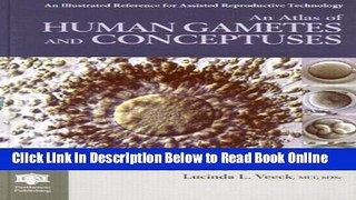 Read An Atlas of Human Gametes and Conceptuses: An Illustrated Reference for Assisted Reproductive