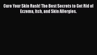 Read Books Cure Your Skin Rash! The Best Secrets to Get Rid of Eczema Itch and Skin Allergies.