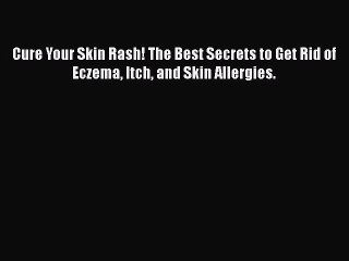 Read Books Cure Your Skin Rash! The Best Secrets to Get Rid of Eczema Itch and Skin Allergies.