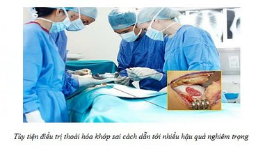 Thuốc giảm đau nhức xương khớp và tác dụng phụ