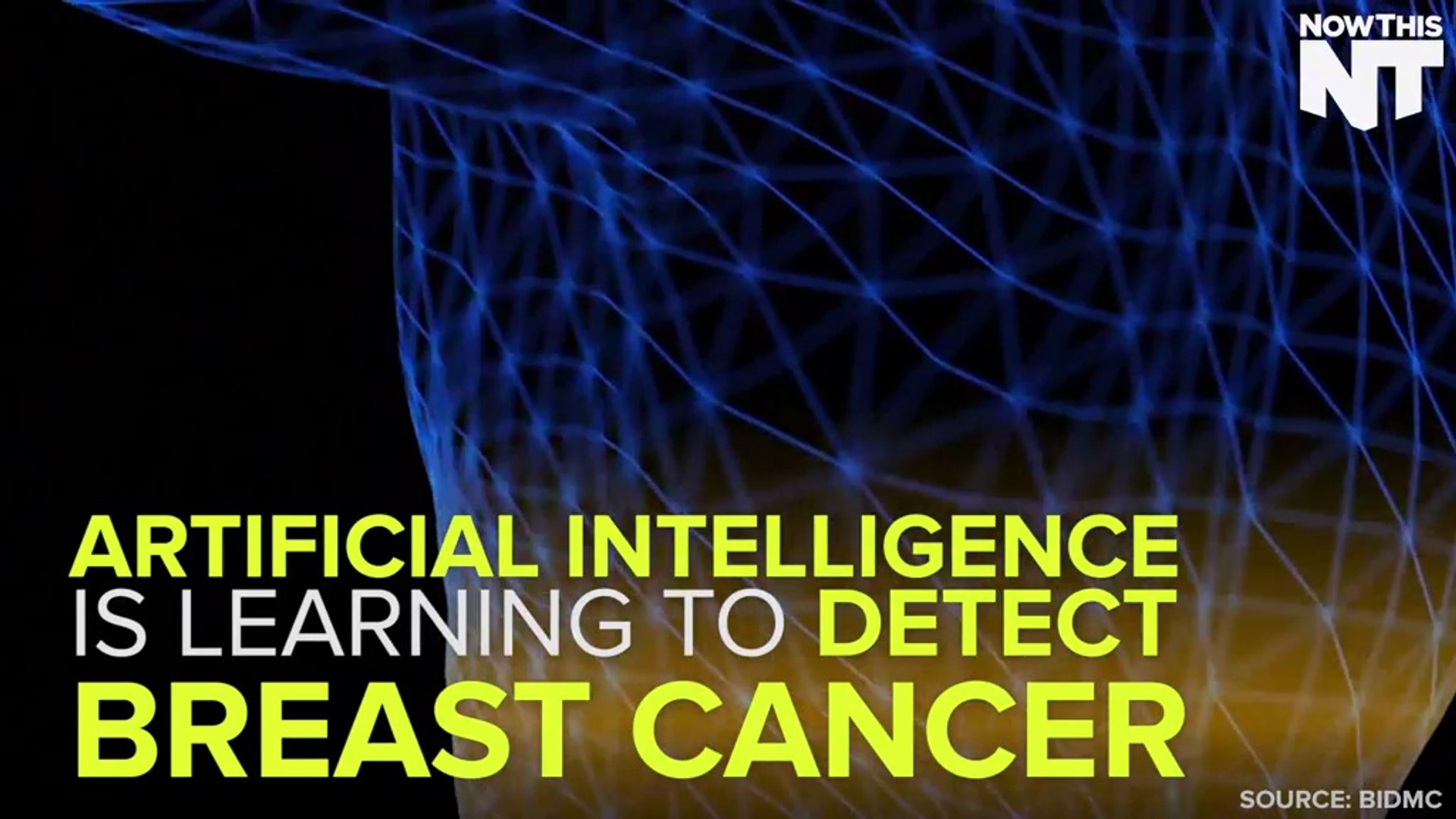 Artificial Intelligence Can Detect Breast Cancer