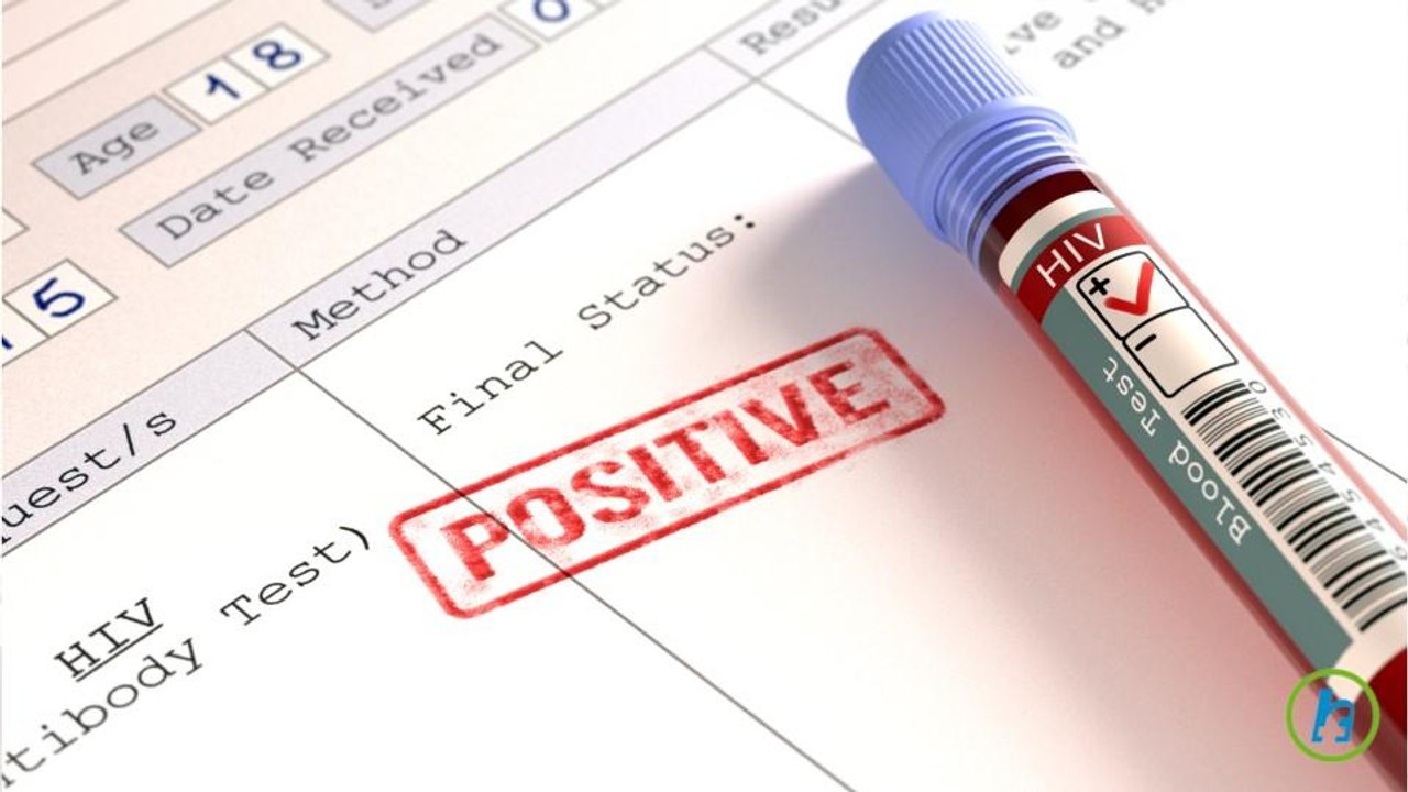 Many HIV Patients Experience Nervous System Issues