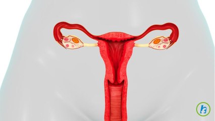 What is Cervical dysplasia?