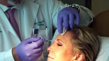 Liquid Facelift South Beach: Botox Juvederm Restylane remove wrinkles Forehead Face Eyes Ears