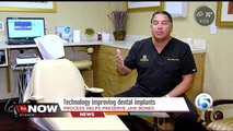 Teeth Next Day - Palm Beach Gardens, FL - Dr. Jay Ajmo