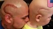 Dad tattoos son’s cancer scar on to his own head, wins father-of-the-year contest - TomoNews