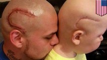 Dad tattoos son’s cancer scar on to his own head, wins father-of-the-year contest - TomoNews