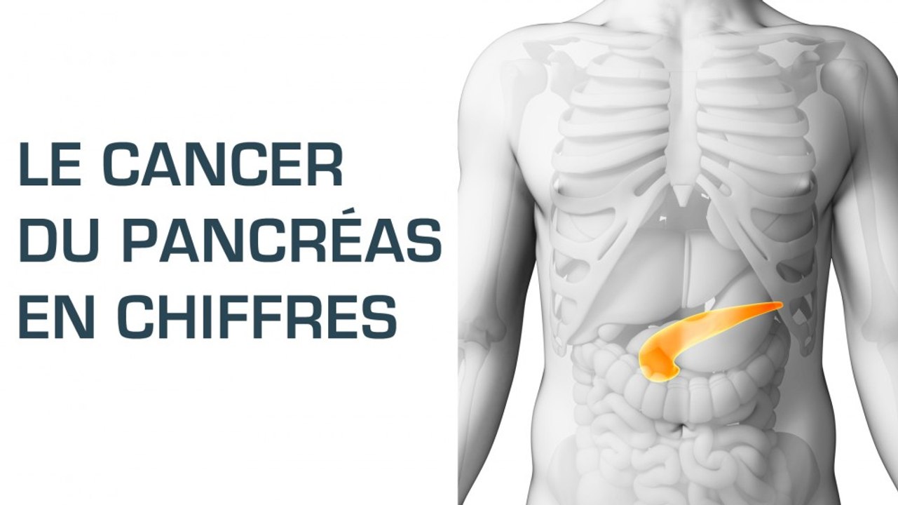 Le cancer du pancréas en chiffres