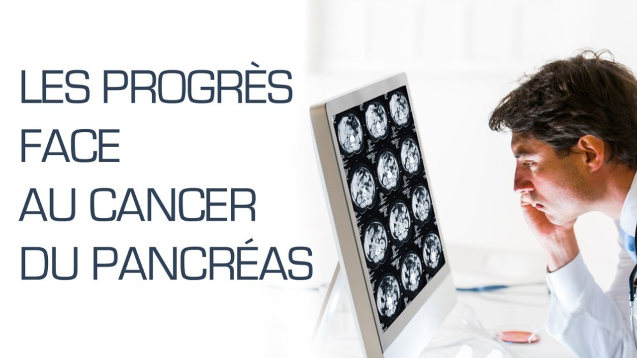 ASCO 2016 : les progrès face au cancer du pancréas