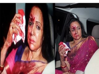 Hema Malini Injured In An Accident | One Die | Three Injured
