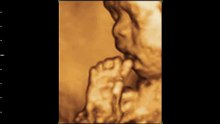 3D/4D Ultrasound BabyICON 28 weeks 玩腳 BB