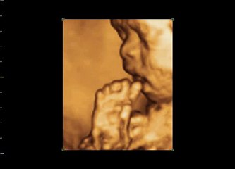 3D/4D Ultrasound BabyICON 28 weeks 玩腳 BB