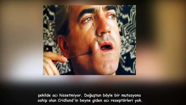 Gerçek Süper Güçlere Sahip 5 İnanılmaz İnsan