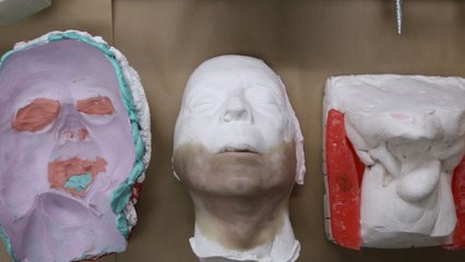 How 3-D Printing Helped Give A Cancer Survivor His Face Back