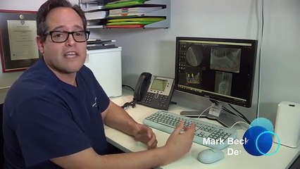 Dental Implants offered by Chase Lodge Dental in Mill Hill North London