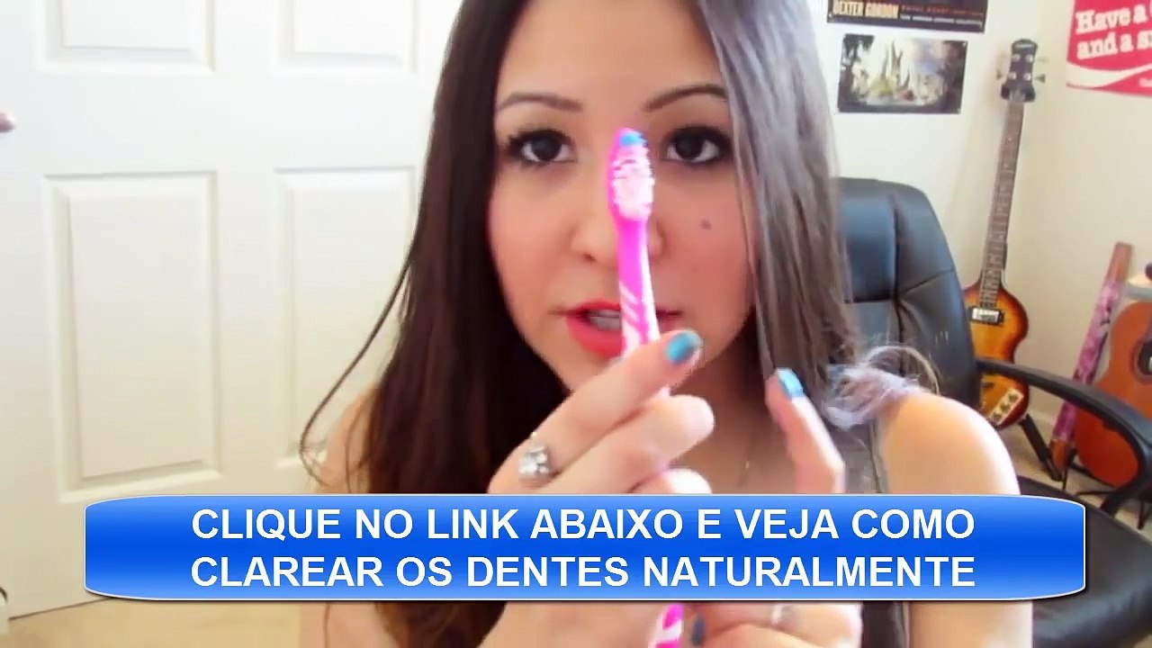 Clareamento dental