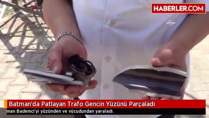 Batman'da Patlayan Trafo Gencin Yüzünü Parçaladı