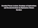 Read Book Brachial Plexus Lesions: Drawings of Explorations and Reconstructions by Algimantas