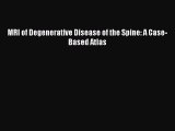 Download Book MRI of Degenerative Disease of the Spine: A Case-Based Atlas ebook textbooks