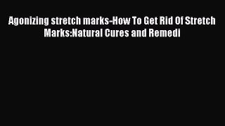Download Agonizing stretch marks-How To Get Rid Of Stretch Marks:Natural Cures and Remedi Ebook