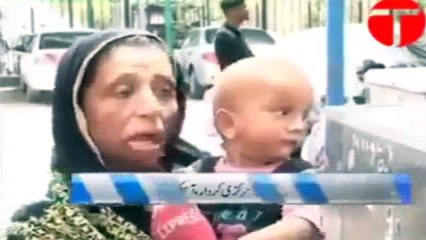 Acid Victim Lady Who Played Main Role in “Saving Face” Exposed Sharmeen Obaid Chinoy