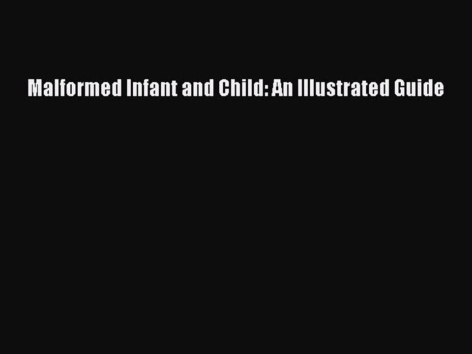 Read Malformed Infant and Child: An Illustrated Guide Ebook Online