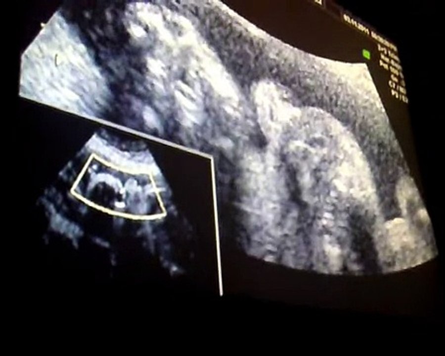 VIRGINIA VIDEO ECOGRAFIA 28 SEMANAS DE EMBARAZO 28 weeks of pregnancy