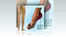pain in arch of foot|  1-623-295-1511 | podiatrist phoenix| custom orthotics| foot pain top|  85308