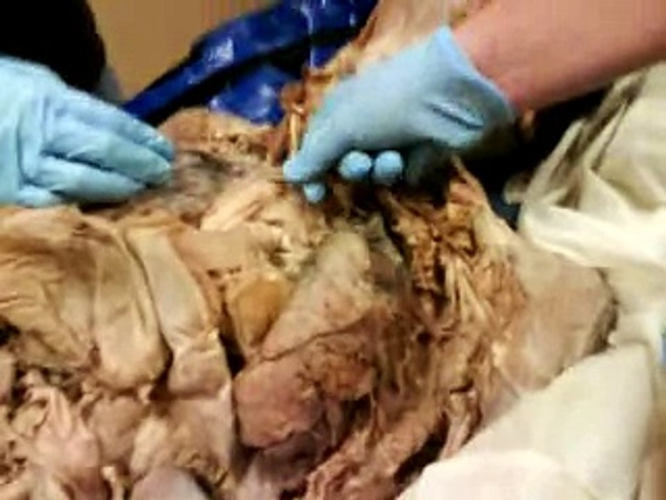 Cadaver Arteries & Veins 1