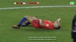 Alexis Sánchez Breaks His LEG - Argentina vs. Chile Copa America 2016