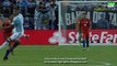 Alexis Sánchez Horror Injury HD Argentina 0-0 Chile   Copa America Centenario   26.06.2016 HD