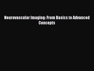 Download Neurovascular Imaging: From Basics to Advanced Concepts PDF Online