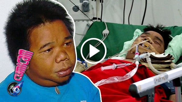 Hendrik Ceper Terbaring Koma - Cumicam 27 Juni 2016