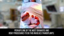 10 Most Shocking Transplants Ever Performed on People