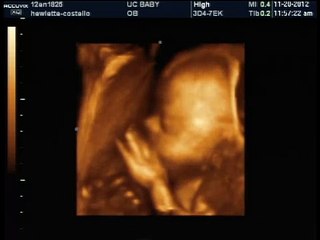 Baby boys heart beat 25 weeks 3d ultrasound nov 20 2012