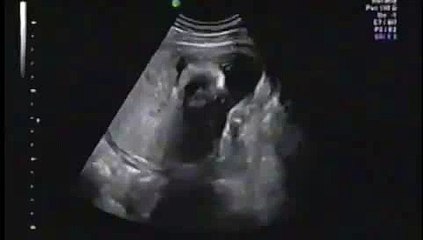 Kick, the baby - 20 weeks
