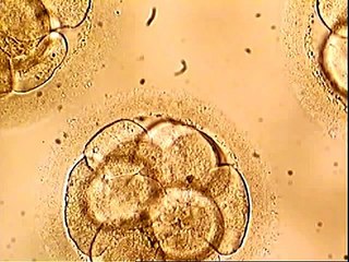 Day 3 Vitrified thawed Embryo -Laser Assisted Hatching-Dr.VM.Thomas -CFC