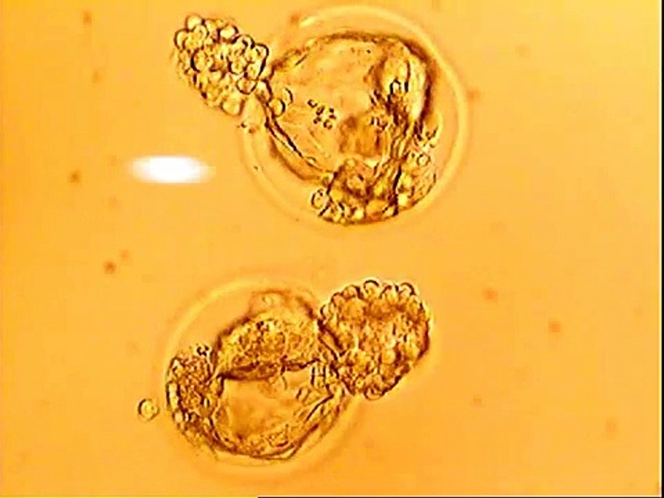 Day 6 Hatching Blastocyst Vitrification - Chennai Fertility Center - Dr.VM.Thomas