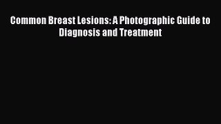 Read Books Common Breast Lesions: A Photographic Guide to Diagnosis and Treatment E-Book Free