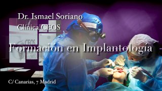 Curso de implantes. Dr Ismael Soriano. Exodoncia 25  Implante 25. Implantología básica